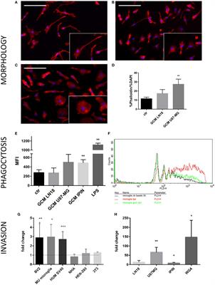 In Search for Reliable Markers of Glioma-Induced Polarization of Microglia